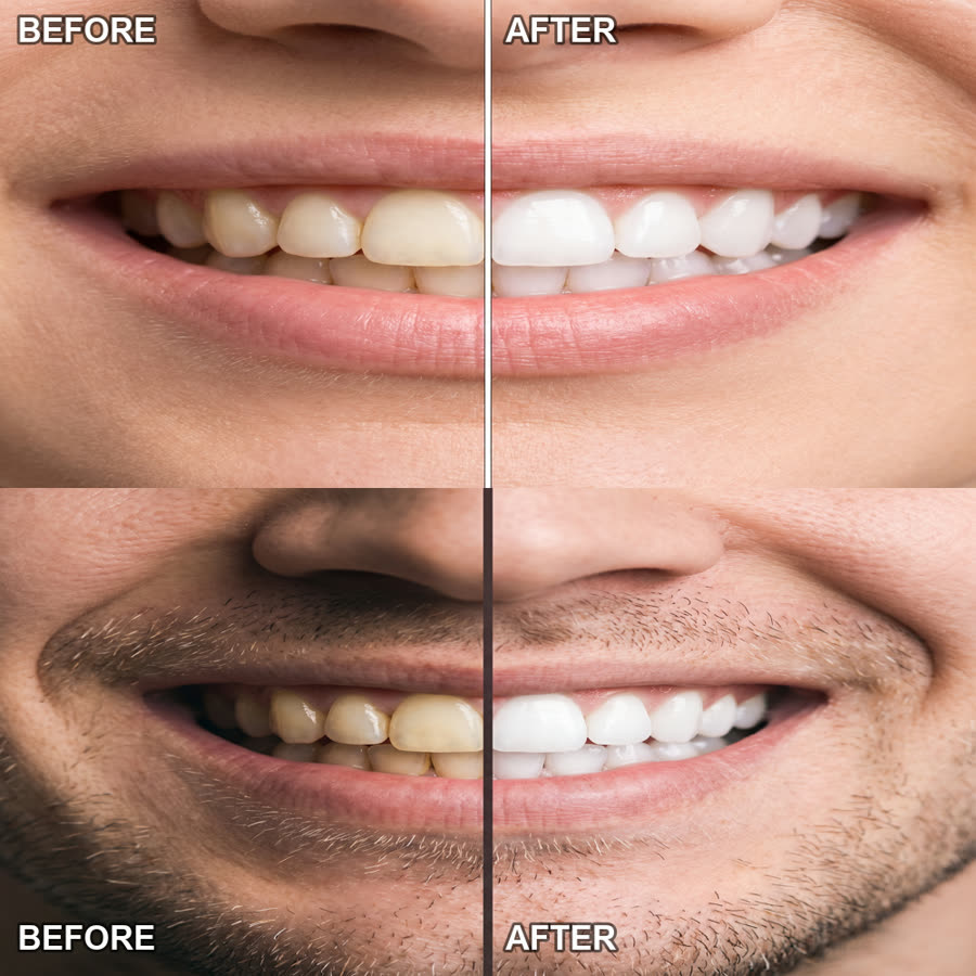 Before and after: yellow tone cancelled to bright white