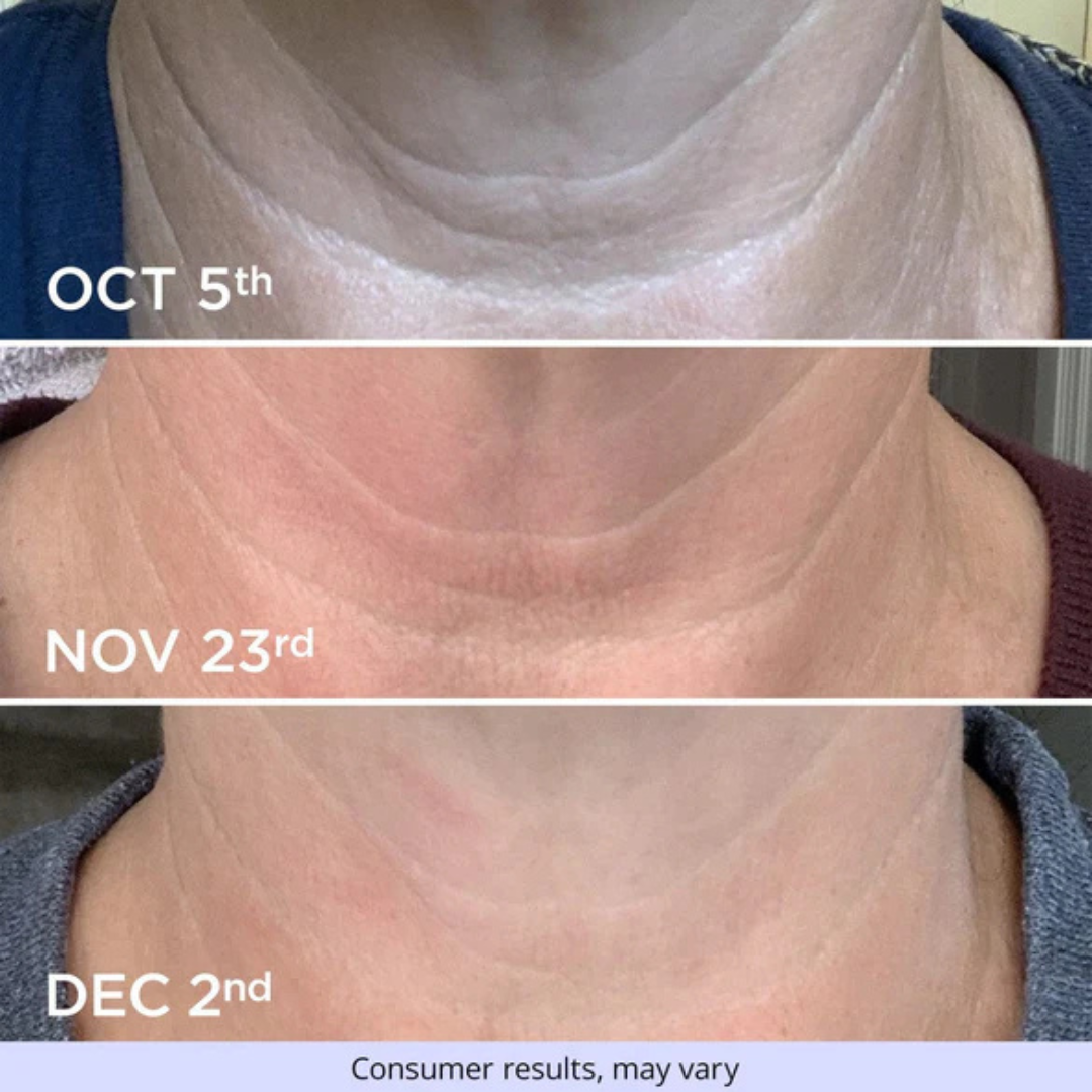 Firming Neck Cream