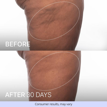 Firming Butt & Thigh Cream